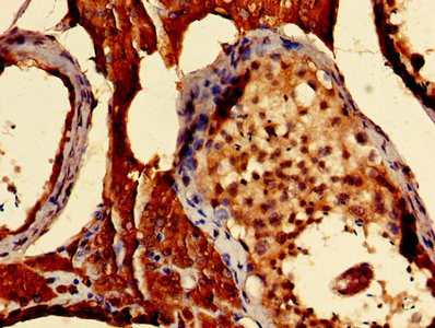 S100A16 Antibody - Immunohistochemistry of paraffin-embedded human testis tissue using S100A16 Antibody at dilution of 1:100