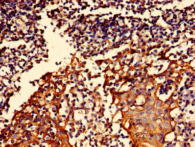 S100A16 Antibody - Immunohistochemistry of paraffin-embedded human tonsil tissue using S100A16 Antibody at dilution of 1:100