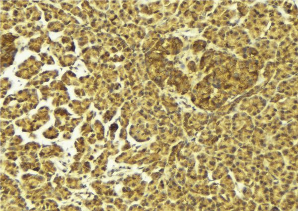 S100A16 Antibody - 1:100 staining mouse pancreas tissue by IHC-P. The sample was formaldehyde fixed and a heat mediated antigen retrieval step in citrate buffer was performed. The sample was then blocked and incubated with the antibody for 1.5 hours at 22°C. An HRP conjugated goat anti-rabbit antibody was used as the secondary.