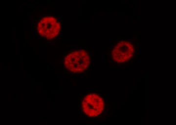 S100A16 Antibody - Staining NIH-3T3 cells by IF/ICC. The samples were fixed with PFA and permeabilized in 0.1% Triton X-100, then blocked in 10% serum for 45 min at 25°C. The primary antibody was diluted at 1:200 and incubated with the sample for 1 hour at 37°C. An Alexa Fluor 594 conjugated goat anti-rabbit IgG (H+L) antibody, diluted at 1/600, was used as secondary antibody.