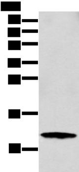 S100A16 Antibody - Western blot analysis of MCF-7 cell  using S100A16 Polyclonal Antibody at dilution of 1:300