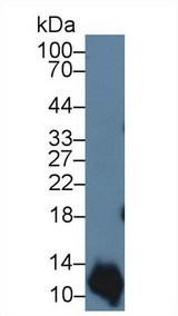 S100A2 Antibody - Western Blot; Sample: Human A431 cell lysate; Primary Ab: 3µg/ml Rabbit Anti-Bovine S100A2 Antibody Second Ab: 0.2µg/mL HRP-Linked Caprine Anti-Rabbit IgG Polyclonal Antibody