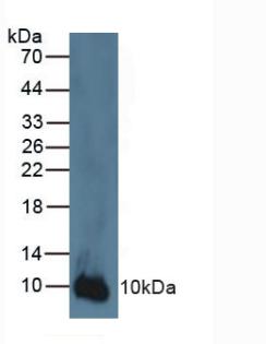S100A2 Antibody - Western Blot; Sample: Human A431 Cells.