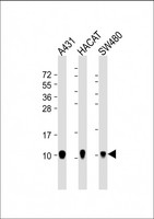 S100A2 Antibody - All lanes: Anti-S100A2 Antibody at 1:4000 dilution. Lane 1: A431 whole cell lysate. Lane 2: HACAT whole cell lysate. Lane 3: SW480 whole cell lysate Lysates/proteins at 20 ug per lane. Secondary Goat Anti-mouse IgG, (H+L), Peroxidase conjugated at 1:10000 dilution. Predicted band size: 11 kDa. Blocking/Dilution buffer: 5% NFDM/TBST.