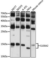 S100A2 Antibody - Western blot analysis of extracts of various cell lines, using S100A2 antibody at 1:3000 dilution. The secondary antibody used was an HRP Goat Anti-Rabbit IgG (H+L) at 1:10000 dilution. Lysates were loaded 25ug per lane and 3% nonfat dry milk in TBST was used for blocking. An ECL Kit was used for detection and the exposure time was 60s.