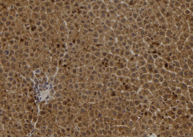 S100A2 Antibody - 1:100 staining rat liver tissue by IHC-P. The sample was formaldehyde fixed and a heat mediated antigen retrieval step in citrate buffer was performed. The sample was then blocked and incubated with the antibody for 1.5 hours at 22°C. An HRP conjugated goat anti-rabbit antibody was used as the secondary.