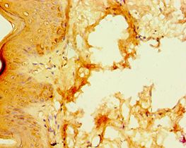 S100A3 / S100E Antibody - Immunohistochemistry of paraffin-embedded human skin using antibody at 1:100 dilution.