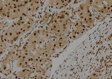 S100A3 / S100E Antibody - 1:100 staining human kidney tissue by IHC-P. The sample was formaldehyde fixed and a heat mediated antigen retrieval step in citrate buffer was performed. The sample was then blocked and incubated with the antibody for 1.5 hours at 22°C. An HRP conjugated goat anti-rabbit antibody was used as the secondary.