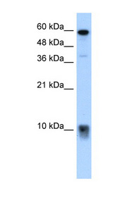 S100A3 / S100E Antibody - S100A3 antibody ARP42084_T100-NP_002951-S100A3(S100 calcium binding protein A3) Antibody Western blot of OVCAR-3 cell lysate.  This image was taken for the unconjugated form of this product. Other forms have not been tested.