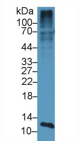 S100A4 / FSP1 Antibody - Western Blot; Sample: Mouse Placenta lysate; Primary Ab: 1µg/ml Rabbit Anti-Mouse S100A4 Antibody Second Ab: 0.2µg/mL HRP-Linked Caprine Anti-Rabbit IgG Polyclonal Antibody