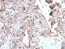 S100A4 / FSP1 Antibody - Formalin-fixed, paraffin-embedded human Placenta stained with S100A4 Recombinant Rabbit Monoclonal Antibody (S100A4/2750R).