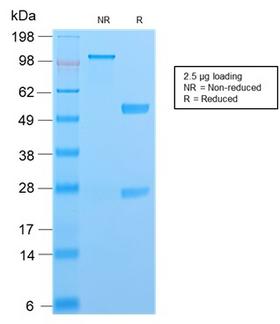 S100A4 / FSP1 Antibody - SDS-PAGE Analysis Purified S100A4 Recombinant Rabbit Monoclonal Antibody (S100A4/2750R). Confirmation of Purity and Integrity of Antibody.