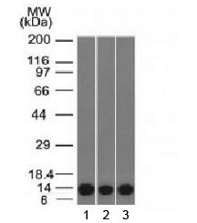 S100A4 / FSP1 Antibody - Western blot testing of human 1) HeLa, 2) A549 and 3) A431 cell lysate FSP1 antibody. Predicted molecular weight ~12 kDa.