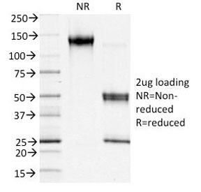 S100A4 / FSP1 Antibody - SDS-PAGE Analysis of Purified, BSA-Free FSP1 Antibody (clone S100A4/1481). Confirmation of Integrity and Purity of the Antibody.