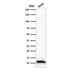 S100A4 / FSP1 Antibody - Western blot testing of human HeLa cell lysate with FSP1 antibody. Predicted molecular weight ~12 kDa.