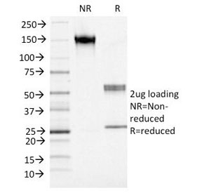 S100A4 / FSP1 Antibody - SDS-PAGE Analysis of Purified, BSA-Free S100A4 Antibody (clone S100A4/1482). Confirmation of Integrity and Purity of the Antibody.