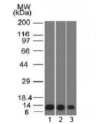 S100A4 / FSP1 Antibody - Western blot testing of human 1) HeLa, 2) A549 and 3) A431 cell lysate S100A4 antibody (clone S100A4/1482). Predicted molecular weight ~12 kDa.