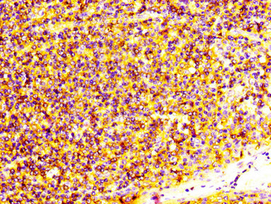 S100A4 / FSP1 Antibody - IHC image of S100A4 Antibody diluted at 1:600 and staining in paraffin-embedded human tonsil tissue performed on a Leica BondTM system. After dewaxing and hydration, antigen retrieval was mediated by high pressure in a citrate buffer (pH 6.0). Section was blocked with 10% normal goat serum 30min at RT. Then primary antibody (1% BSA) was incubated at 4°C overnight. The primary is detected by a biotinylated secondary antibody and visualized using an HRP conjugated SP system.