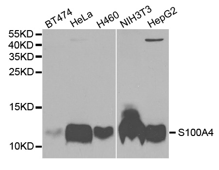 S100A4 / FSP1 Antibody - Western blot analysis of extracts of various cell lines.
