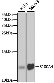 S100A4 / FSP1 Antibody - Western blot analysis of extracts of various cell lines, using S100A4 antibody at 1:1000 dilution. The secondary antibody used was an HRP Goat Anti-Rabbit IgG (H+L) at 1:10000 dilution. Lysates were loaded 25ug per lane and 3% nonfat dry milk in TBST was used for blocking. An ECL Kit was used for detection and the exposure time was 90s.