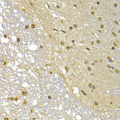 S100A4 / FSP1 Antibody - Immunohistochemistry of paraffin-embedded rat brain using S100A4 antibodyat dilution of 1:100 (40x lens).