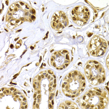 S100A4 / FSP1 Antibody - Immunohistochemistry of paraffin-embedded human mammary gland using S100A4 antibodyat dilution of 1:100 (40x lens).