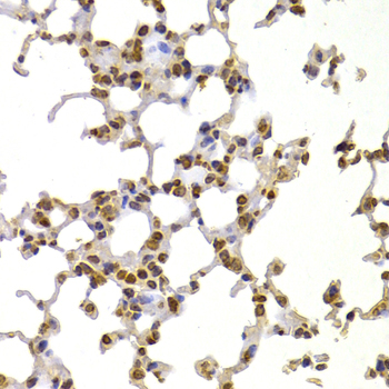 S100A4 / FSP1 Antibody - Immunohistochemistry of paraffin-embedded mouse lung using S100A4 antibodyat dilution of 1:100 (40x lens).