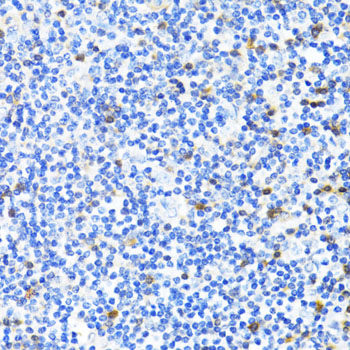 S100A4 / FSP1 Antibody - Immunohistochemistry of paraffin-embedded human tonsil using S100A4 antibodyat dilution of 1:100 (40x lens).