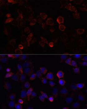 S100A4 / FSP1 Antibody - Immunofluorescence analysis of HeLa cells using S100A4 antibodyat dilution of 1:100. Blue: DAPI for nuclear staining.