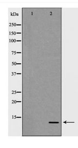 S100A4 / FSP1 Antibody - Western blot of S100 A4 expression in Human Placenta lysate