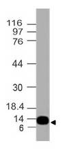 S100A4 / FSP1 Antibody - Fig-1: Expression analysis of S100A4. Anti-S100A4 antibody was tested at 0.5 µg/ml on A549 lysate.