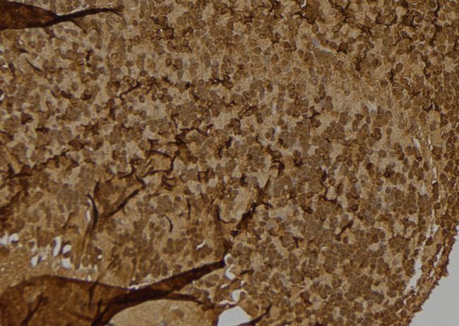 S100A4 / FSP1 Antibody - 1:100 staining mouse brain tissue by IHC-P. The sample was formaldehyde fixed and a heat mediated antigen retrieval step in citrate buffer was performed. The sample was then blocked and incubated with the antibody for 1.5 hours at 22°C. An HRP conjugated goat anti-rabbit antibody was used as the secondary.