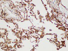 S100A4 / FSP1 Antibody - Immunohistochemistry of paraffin-embedded Human lung using S100A4 Polycloanl Antibody at dilution of 1:50