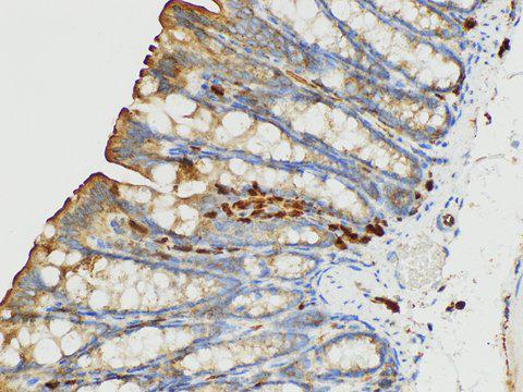 S100A4 / FSP1 Antibody - Immunohistochemistry of paraffin-embedded Mouse colon using S100A4 Polycloanl Antibody at dilution of 1:50