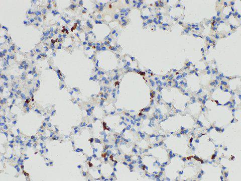 S100A4 / FSP1 Antibody - Immunohistochemistry of paraffin-embedded Mouse lung using S100A4 Polycloanl Antibody at dilution of 1:50
