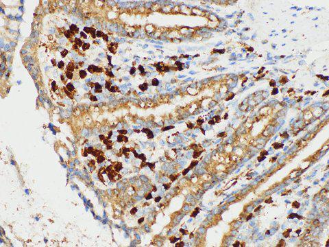 S100A4 / FSP1 Antibody - Immunohistochemistry of paraffin-embedded Rat colon using S100A4 Polycloanl Antibody at dilution of 1:50
