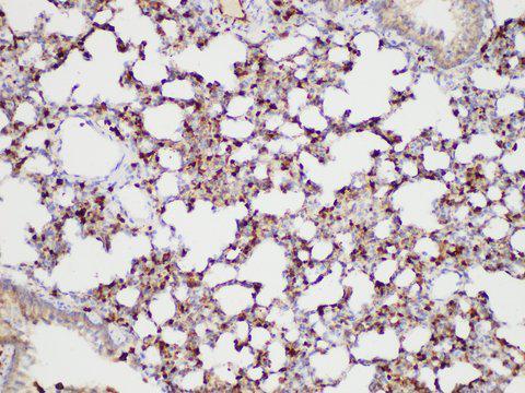 S100A4 / FSP1 Antibody - Immunohistochemistry of paraffin-embedded Rat lung using S100A4 Polycloanl Antibody at dilution of 1:50