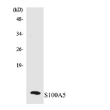 S100A5 Antibody - Western blot analysis of the lysates from K562 cells using S100A5 antibody.