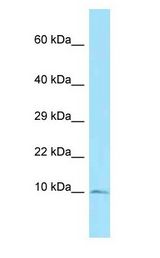 S100A5 Antibody - S100A5 antibody Western Blot of Mouse Small Intestine.  This image was taken for the unconjugated form of this product. Other forms have not been tested.