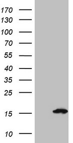 S100A5 Antibody - HEK293T cells were transfected with the pCMV6-ENTRY control. (Left lane) or pCMV6-ENTRY S100A5. (Right lane) cDNA for 48 hrs and lysed. Equivalent amounts of cell lysates. (5 ug per lane) were separated by SDS-PAGE and immunoblotted with anti-S100A5. (1:2000)