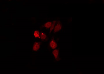 S100A5 Antibody - Staining HepG2 cells by IF/ICC. The samples were fixed with PFA and permeabilized in 0.1% Triton X-100, then blocked in 10% serum for 45 min at 25°C. The primary antibody was diluted at 1:200 and incubated with the sample for 1 hour at 37°C. An Alexa Fluor 594 conjugated goat anti-rabbit IgG (H+L) Ab, diluted at 1/600, was used as the secondary antibody.
