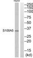S100A5 Antibody - Western blot analysis of extracts from HepG2 cells, using RFTN1 antibody.