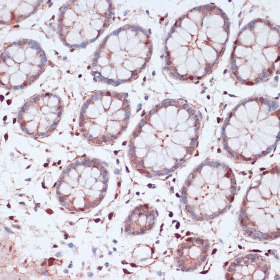 S100A5 Antibody - Immunohistochemistry of paraffin-embedded Human colon using S100A5 Polyclonal Antibody at dilution of 1:100 (40x lens).