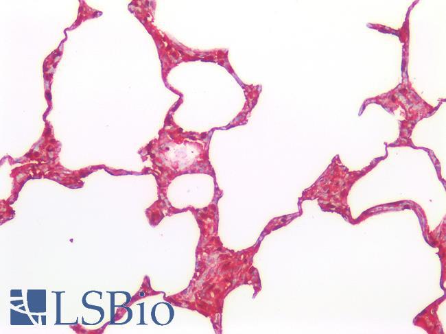 S100A6 / Calcyclin Antibody - Human Lung: Formalin-Fixed, Paraffin-Embedded (FFPE)