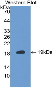 S100A6 / Calcyclin Antibody - Western blot of recombinant S100A6.