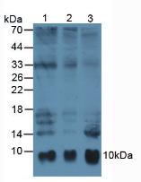 S100A6 / Calcyclin Antibody - Western Blot; Sample: Lane1: Human Hela Cells; Lane2: Human A549 Cells; Lane3: Human Mcf7 Cells.