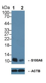 S100A6 / Calcyclin Antibody - Knockout Varification: Lane 1: Wild-type Hela cell lysate; Lane 2: S100A6 knockout Hela cell lysate; Predicted MW: 10kDa ; Observed MW: 10kDa; Primary Ab: 4µg/ml Rabbit Anti-Human S100A6 Antibody; Second Ab: 0.2µg/mL HRP-Linked Caprine Anti-Rabbit IgG Polyclonal Antibody;
