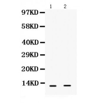 S100A6 / Calcyclin Antibody - S100 alpha 6 antibody Western blot. All lanes: Anti S100 alpha 6 at 0.5 ug/ml. Lane 1: Rat Liver Tissue Lysate at 50 ug. Lane 2: A431 Whole Cell Lysate at 40 ug. Predicted band size: 10 kD. Observed band size: 10 kD.
