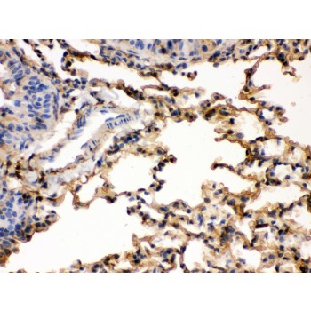S100A6 / Calcyclin Antibody - S100 alpha 6 antibody IHC-paraffin. IHC(P): Rat Lung Tissue.