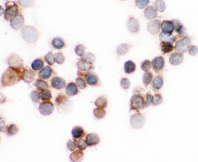 S100A6 / Calcyclin Antibody - IHC analysis of S100A6 using anti-S100A6 antibody. S100A6 was detected in immunocytochemical section of LOVO 1 cell. Heat mediated antigen retrieval was performed in citrate buffer (pH6, epitope retrieval solution) for 20 mins. The tissue section was blocked with 10% goat serum. The tissue section was then incubated with 1µg/ml rabbit anti-S100A6 Antibody overnight at 4°C. Biotinylated goat anti-rabbit IgG was used as secondary antibody and incubated for 30 minutes at 37°C. The tissue section was developed using Strepavidin-Biotin-Complex (SABC) with DAB as the chromogen.